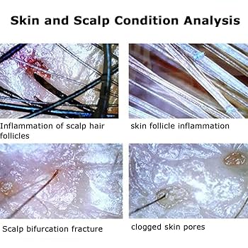 K2-NON 脱毛器 HIGH SENSE  ESTHETIC SYST Amazon.com: NYMFEA Skin Diagnosis Hair Analyzer, 9 Inch